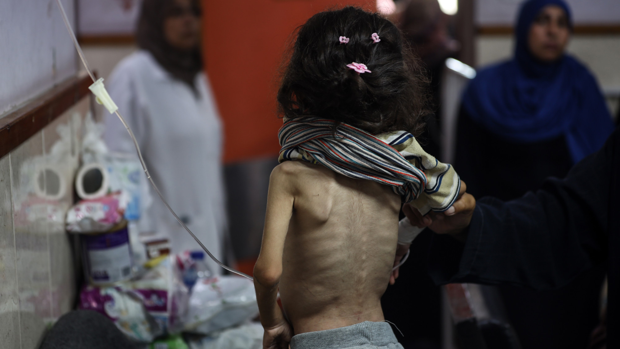 طفل فلسطيني يعاني من سوء التغذية يتلقى العلاج في مستشفى شهداء الأقصى في دير البلح في 1 يونيو 2024 (مجدي فتحي/نور فوتو عبر رويترز)
